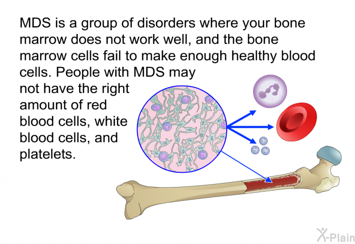 MDS is a group of disorders where your bone marrow does not work well, and the bone marrow cells fail to make enough healthy blood cells. People with MDS may not have the right amount of red blood cells, white blood cells, and platelets.