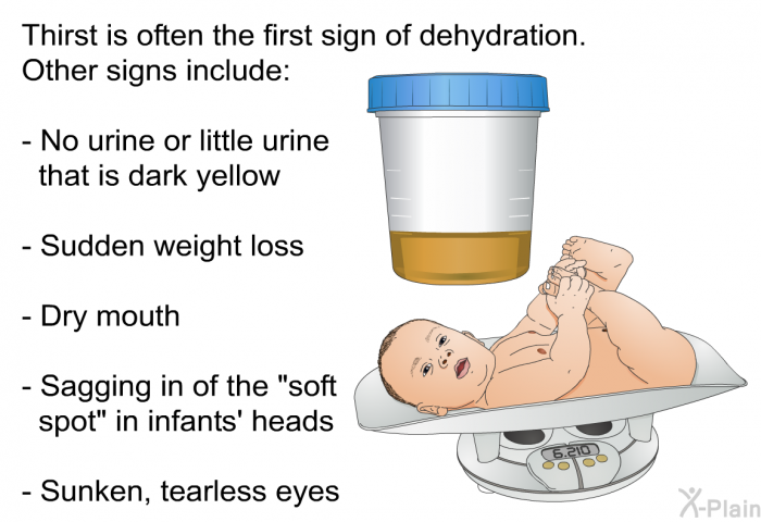 Thirst is often the first sign of dehydration. Other signs include:  No urine or little urine that is dark yellow Sudden weight loss Dry mouth Sagging in of the "soft spot" in infants' heads Sunken, tearless eyes