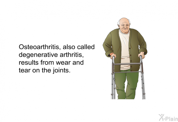 Osteoarthritis, also called degenerative arthritis, results from wear and tear on the joints.