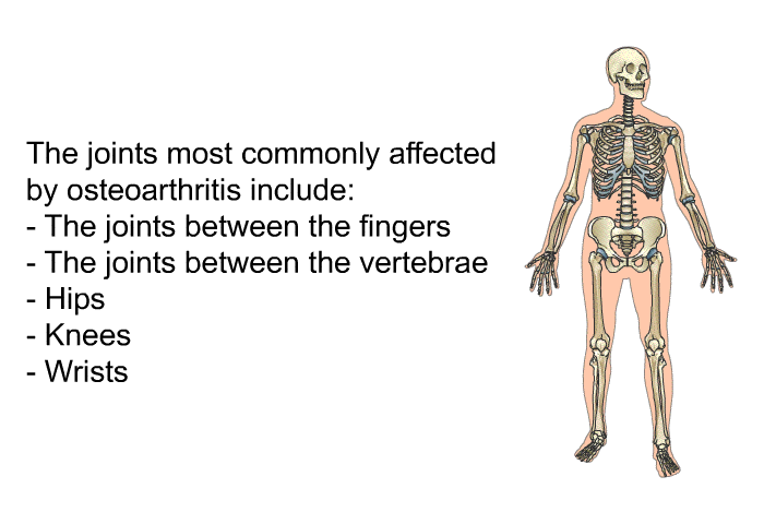 The joints most commonly affected by osteoarthritis include:  The joints between the fingers The joints between the vertebrae Hips Knees Wrists
