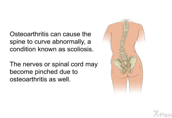 Osteoarthritis can cause the spine to curve abnormally, a condition known as scoliosis. The nerves or spinal cord may become pinched due to osteoarthritis as well.