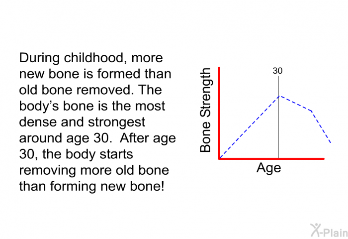 During childhood, more new bone is formed than old bone removed. The body's bone is the most dense and strongest around age 30. After age 30, the body starts removing more old bone than forming new bone!