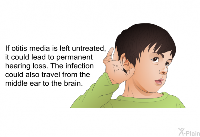 If otitis media is left untreated, it could lead to permanent hearing loss. The infection could also travel from the middle ear to the brain.