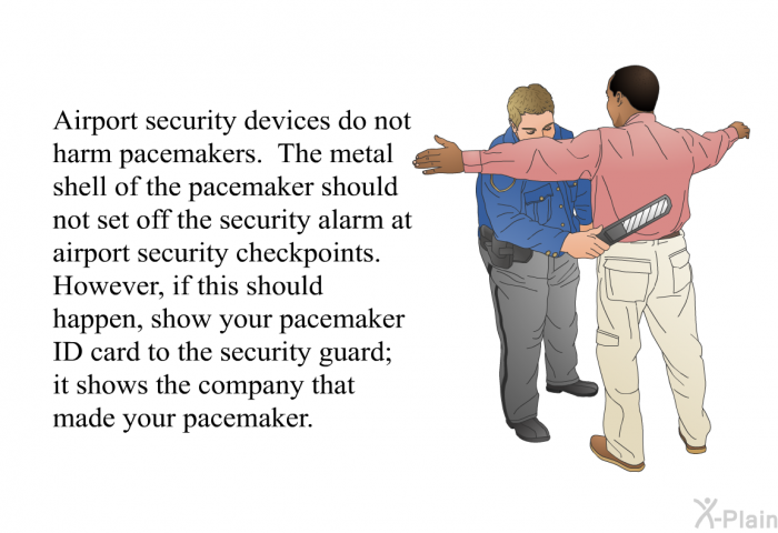 Airport security devices do not harm pacemakers. The metal shell of the pacemaker should not set off the security alarm at airport security checkpoints. However, if this should happen, show your pacemaker ID card to the security guard; it shows the company that made your pacemaker.