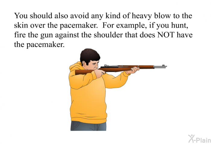 You should also avoid any kind of heavy blow to the skin over the pacemaker. For example, if you hunt, fire the gun against the shoulder that does NOT have the pacemaker.