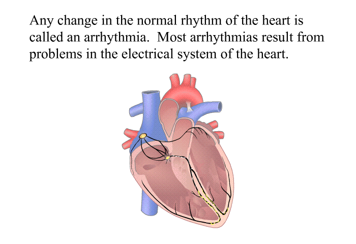 Any change in the normal rhythm of the heart is called an arrhythmia. Most arrhythmias result from problems in the electrical system of the heart.