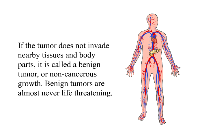 If the tumor does not invade nearby tissues and body parts, it is called a benign tumor, or non-cancerous growth. Benign tumors are almost never life threatening.