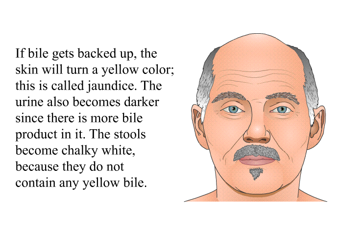 If bile gets backed up, the skin will turn a yellow color; this is called jaundice. The urine also becomes darker since there is more bile product in it. The stools become chalky white, because they do not contain any yellow bile.