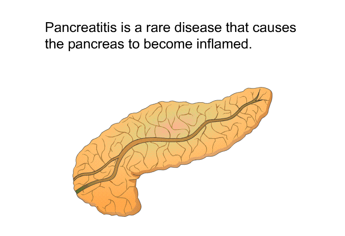 Pancreatitis is a rare disease that causes the pancreas to become inflamed.