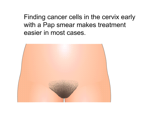 Finding cancer cells in the cervix early with a Pap smear makes treatment easier in most cases.