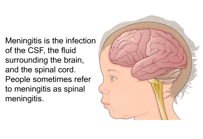Meningitis is the infection of the CSF, the fluid surrounding the brain, and the spinal cord. People sometimes refer to meningitis as spinal meningitis.