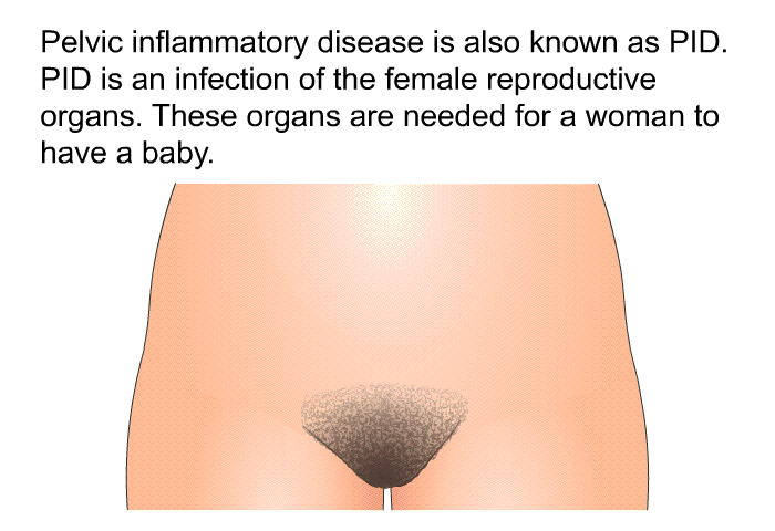 Pelvic inflammatory disease is also known as PID. PID is an infection of the female reproductive organs. These organs are needed for a woman to have a baby.
