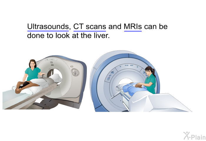 Ultrasounds, CT scans and MRIs can be done to look at the liver.