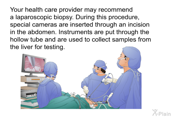 Your health care provider may recommend a laparoscopic biopsy. During this procedure, special cameras are inserted through an incision in the abdomen. Instruments are put through the hollow tube and are used to collect samples from the liver for testing.