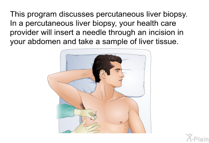 This health information discusses percutaneous liver biopsy. In a percutaneous liver biopsy, your health care provider will insert a needle through an incision in your abdomen and take a sample of liver tissue.