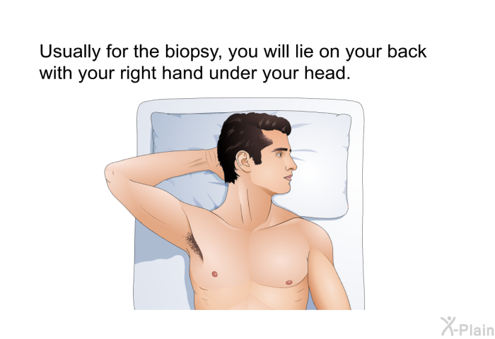 Usually for the biopsy, you will lie on your back with your right hand under your head.