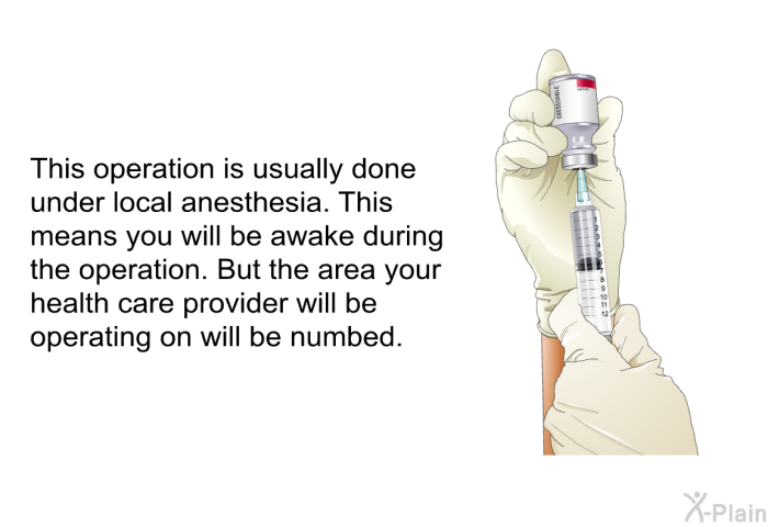 This operation is usually done under local anesthesia. This means you will be awake during the operation. But the area your health care provider will be operating on will be numbed.