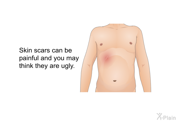 Skin scars can be painful and you may think they are ugly.