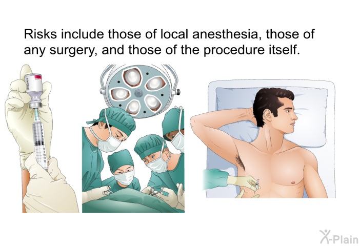 Risks include those of local anesthesia, those of any surgery, and those of the procedure itself.