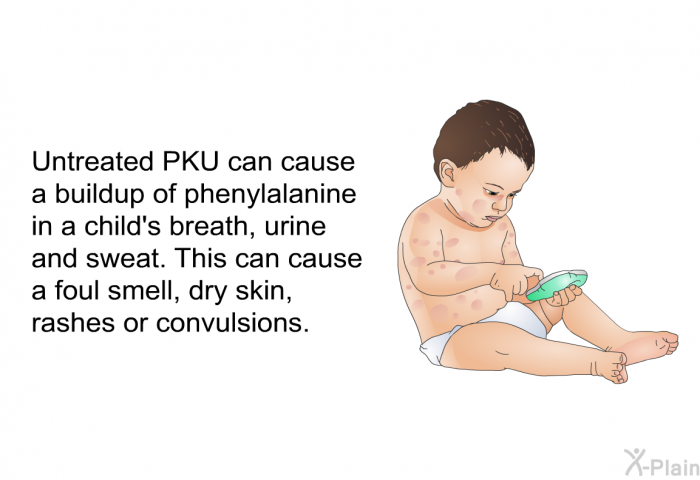 Untreated PKU can cause a buildup of phenylalanine in a child's breath, urine and sweat. This can cause a foul smell, dry skin, rashes or convulsions.