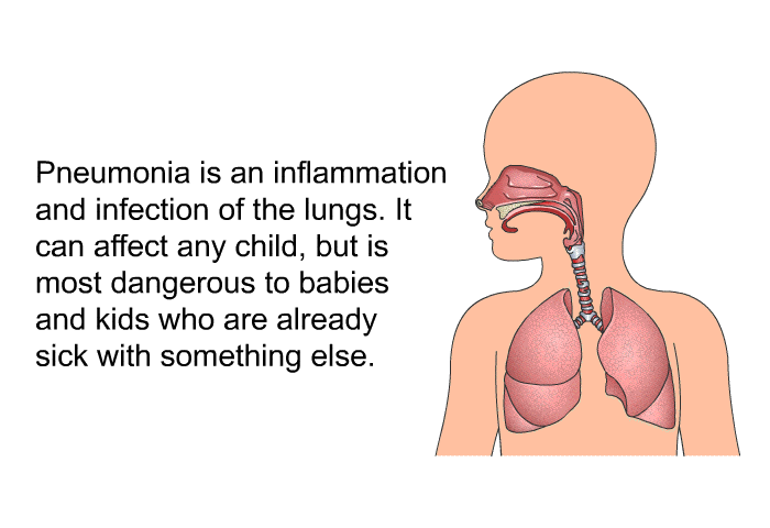 Pneumonia is an inflammation and infection of the lungs. It can affect any child, but is most dangerous to babies and kids who are already sick with something else.