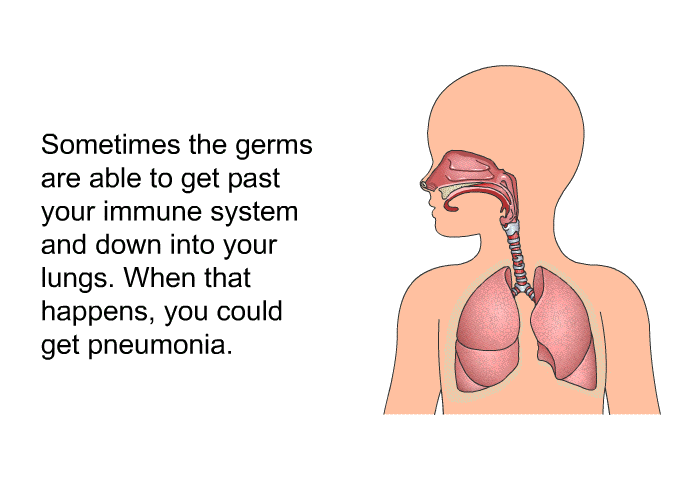 Sometimes the germs are able to get past your immune system and down into your lungs. When that happens, you could get pneumonia.