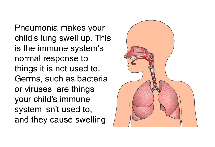 Pneumonia makes your child's lung swell up. This is the immune system's normal response to things it is not used to. Germs, such as bacteria or viruses, are things your child's immune system isn't used to, and they cause swelling.
