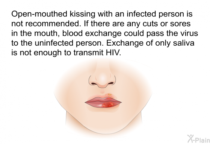 Open-mouthed kissing with an infected person is not recommended. If there are any cuts or sores in the mouth, blood exchange could pass the virus to the uninfected person. Exchange of only saliva is not enough to transmit HIV.