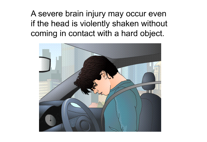 A severe brain injury may occur even if the head is violently shaken without coming in contact with a hard object.