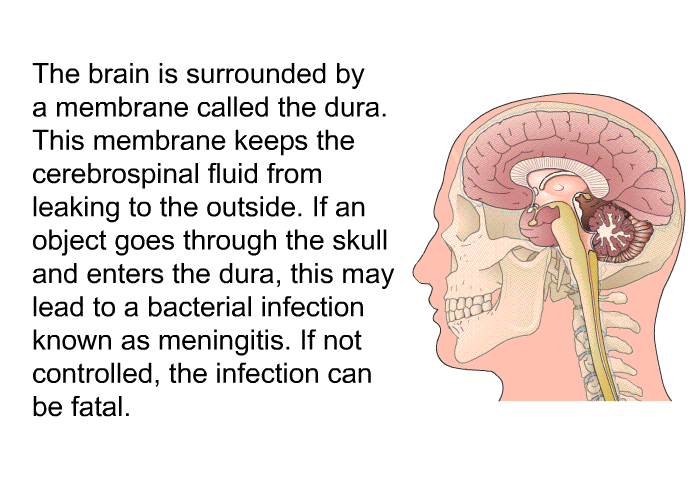 The brain is surrounded by a membrane called the dura. This membrane keeps the cerebrospinal fluid from leaking to the outside. If an object goes through the skull and enters the dura, this may lead to a bacterial infection known as meningitis. If not controlled, the infection can be fatal.