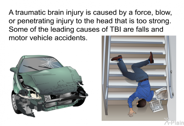 A traumatic brain injury is caused by a force, blow, or penetrating injury to the head that is too strong. Some of the leading causes of TBI are falls and motor vehicle accidents.