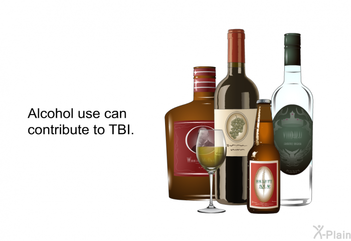 Alcohol use can contribute to TBI.