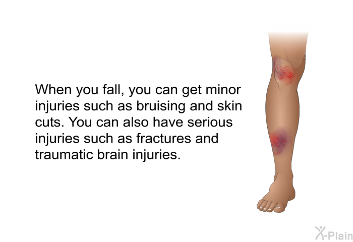 When you fall, you can get minor injuries such as bruising and skin cuts. You can also have serious injuries such as fractures and traumatic brain injuries.