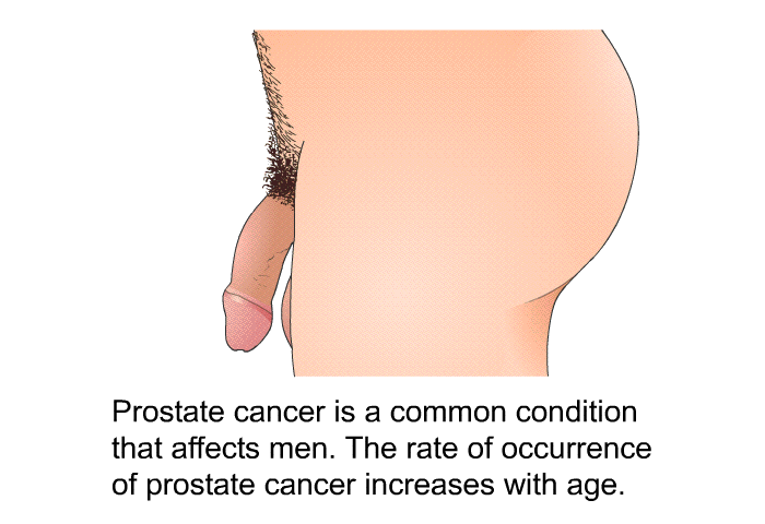 Prostate cancer is a common condition that affects men. The rate of occurrence of prostate cancer increases with age.
