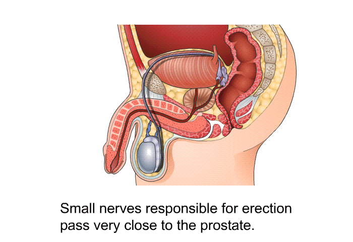 Small nerves responsible for erection pass very close to the prostate.