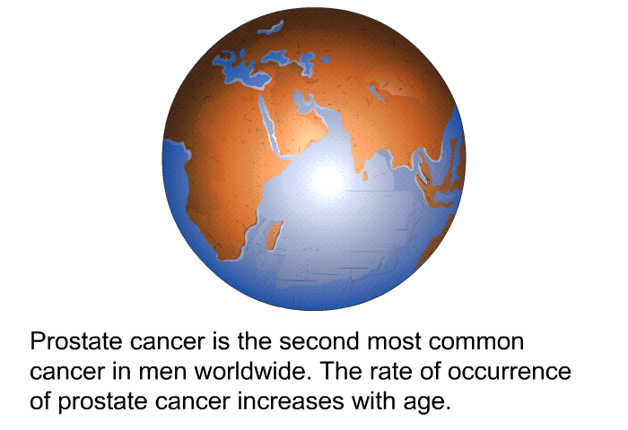 Prostate cancer is the second most common cancer in men worldwide. The rate of occurrence of prostate cancer increases with age.