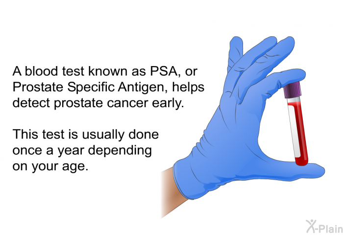 A blood test known as PSA, or Prostate Specific Antigen, helps detect prostate cancer early. This test is usually done once a year depending on your age.