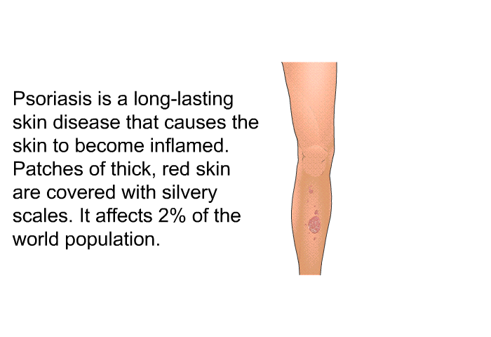 Psoriasis is a long-lasting skin disease that causes the skin to become inflamed. Patches of thick, red skin are covered with silvery scales. It affects 2% of the world population.