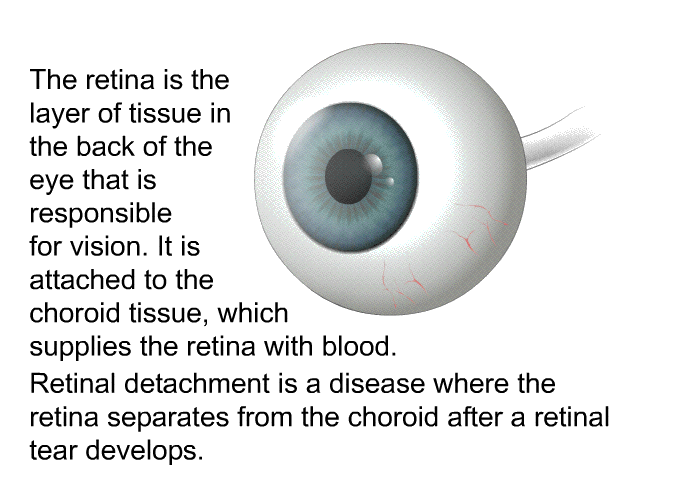 The retina is the layer of tissue in the back of the eye that is responsible for vision. It is attached to the choroid tissue, which supplies the retina with blood. Retinal detachment is a disease where the retina separates from the choroid after a retinal tear develops.
