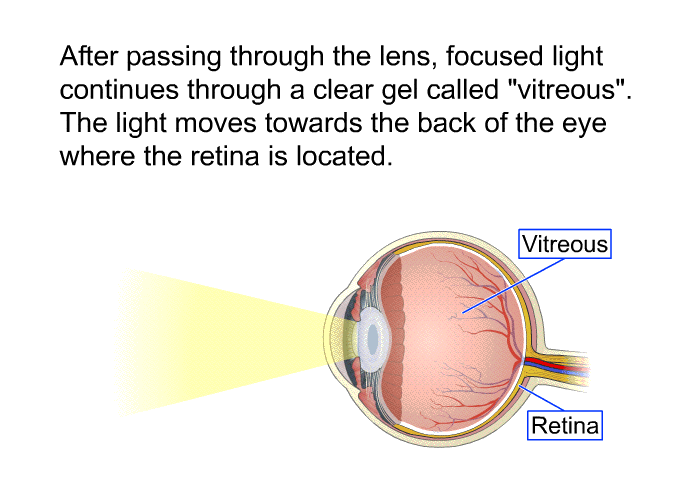 After passing through the lens, focused light continues through a clear gel called “vitreous.” The light moves towards the back of the eye where the retina is located.