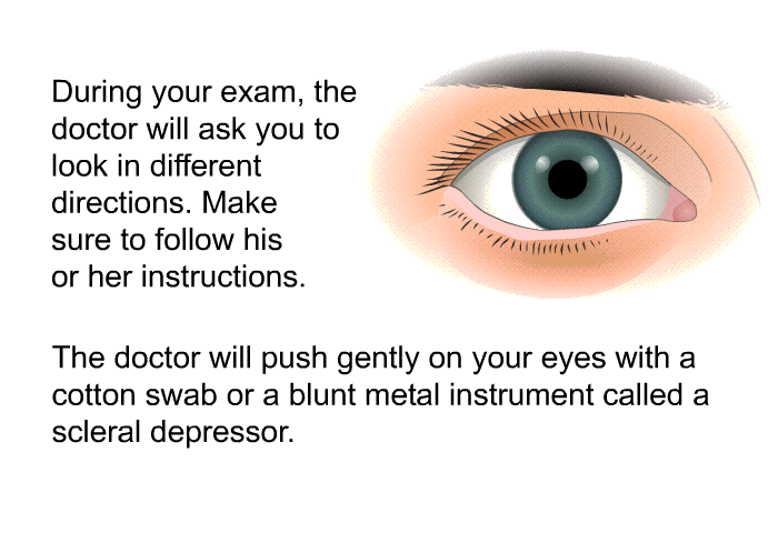 During your exam, the doctor will ask you to look in different directions. Make sure to follow his or her instructions. The doctor will push gently on your eyes with a cotton swab or a blunt metal instrument called a scleral depressor.