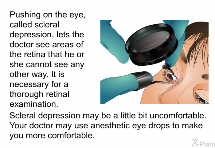 Pushing on the eye, called scleral depression, lets the doctor see areas of the retina that he or she cannot see any other way. It is necessary for a thorough retinal examination. Scleral depression may be a little bit uncomfortable. Your doctor may use anesthetic eye drops to make you more comfortable.