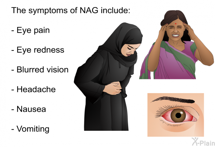 The symptoms of NAG include  Eye pain Eye redness Blurred vision Headache Nausea Vomiting