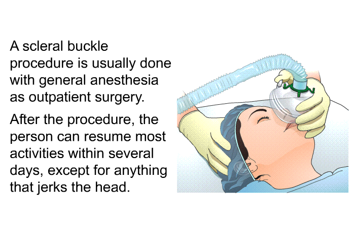 A scleral buckle procedure is usually done with general anesthesia as outpatient surgery. After the procedure, the person can resume most activities within several days, except for anything that jerks the head.