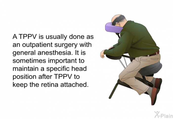 A TPPV is usually done as outpatient surgery with general anesthesia. It is sometimes important to maintain a specific head position after TPPV to keep the retina attached.