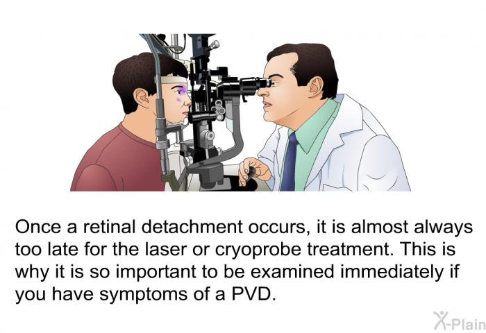 Once a retinal detachment occurs, it is almost always too late for laser or cryoprobe treatment. This is why it is so important to be examined immediately if you have symptoms of a PVD.