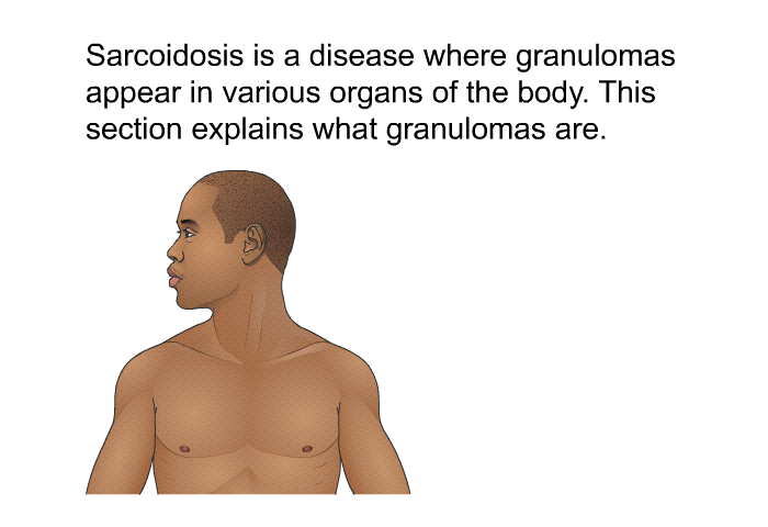 Sarcoidosis is a disease where granulomas appear in various organs of the body. This section explains what granulomas are.