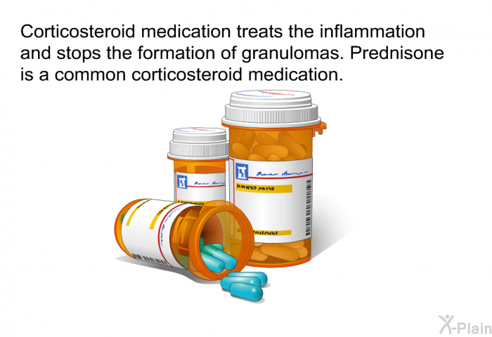 Corticosteroid medication treats the inflammation and stops the formation of granulomas. Prednisone is a common corticosteroid medication.