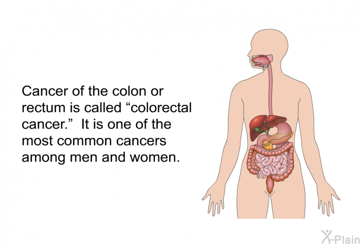 Cancer of the colon or rectum is called “colorectal cancer.” It is one of the most common cancers among men and women.
