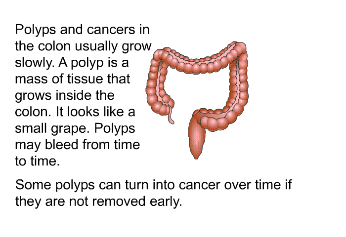 Polyps and cancers in the colon usually grow slowly. A polyp is a mass of tissue that grows inside the colon. It looks like a small grape. Polyps may bleed from time to time. Some polyps can turn into cancer over time if they are not removed early.